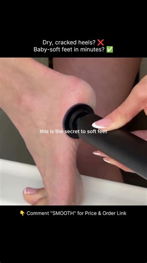 Electric Callus Remover for Feet, Adjustable Various Speed, Powerful Electric Foot File Sander
