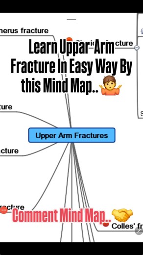 Upper Arm Fracture Through Mind Mind Map..🤷 #medicine #medical_guideliner_ #medical #mbbs | Medicalguideliner