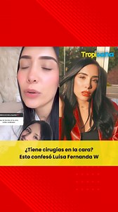 74K views · 272 reactions | Luisa Fernanda W hizo una cajita de preguntas en su cuenta de Instagram para responder algunas curiosidades de sus seguidores. La creadora de contenido habló de los retoques estéticos de su rostro.‼️ #TropicanaBogotá #Tendencias #Famosos #LuisaFernandaW | Tropicana Colombia | Facebook