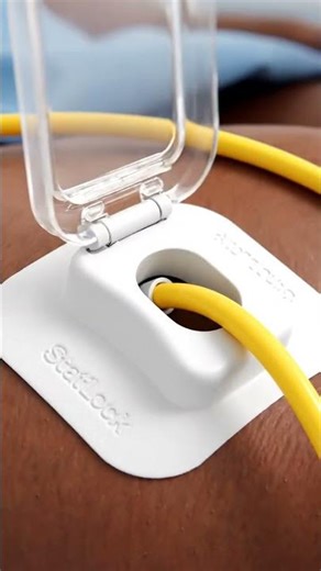 Foley Catheter Securement Device