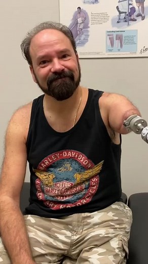 Tom’s first training session with his myoelectric upper extremity prosthesis! 🦾Tom underwent treatment with the OPRA™ Implant System and TMR (Targeted Muscle Reinnervation), a surgical procedure which improves muscular control of the upper limb prosthesis, in 2023. He has been training with the OPRA Transhumeral Training Prosthesis and has met the requirements to begin training with the full length prosthesis. He was fitted with an osseointegration-style COAPT cuff embedded with an array of sur