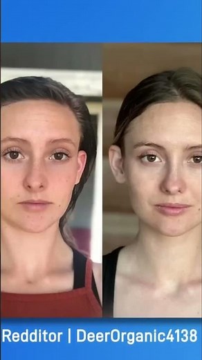 Mewing : Transformez votre visage naturellement! Dr Mike Mew