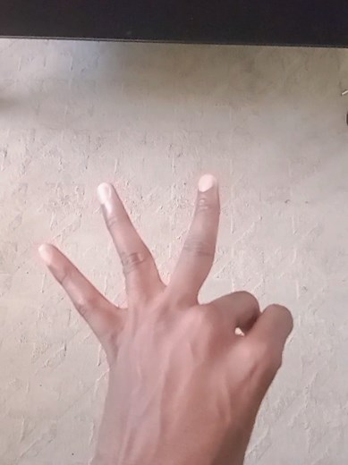 Understanding Unique Finger Anatomy: Six Fingers Explained