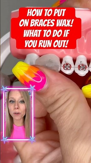 HOW TO PUT ON BRACES WAX *what to do if you HAVE NONE! #braces #wax #asmr