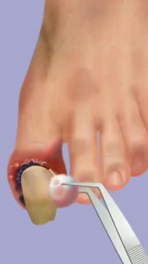 Nails treatment #animation #shortsreels #asmrvideo #asmr #animationvideo | ASMR Makeup