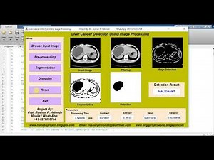 Top 10 Biomedical Projects With Source Code | Top 10 Final Year Projects With Source Code