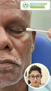 Post-Cataract Cleaning | The Right Way to Protect Your Eyes