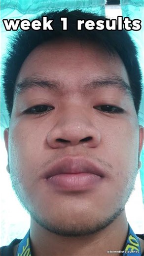 POV: 1 Week on Minoxidil… Did It Work? 👀