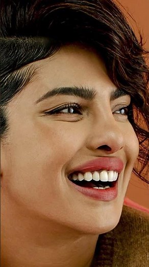 Bollywood Celebrities who got Teeth Braces; Dr. Srishti Bhatia #smilemakeover #newsmile