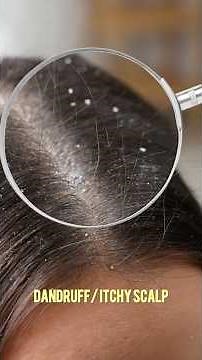 The Right Hair Serum for Your Hair Type! Must-Save Guide ✨ #nykaatv