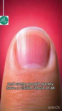 What Is this white mark on your nail?