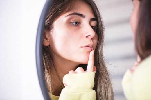 Boutons de fièvre : quelles sont les causes ?