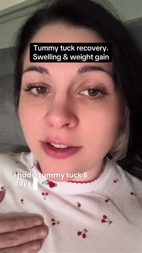 Tummy Tuck Recovery Insights: Swelling and Weight Loss