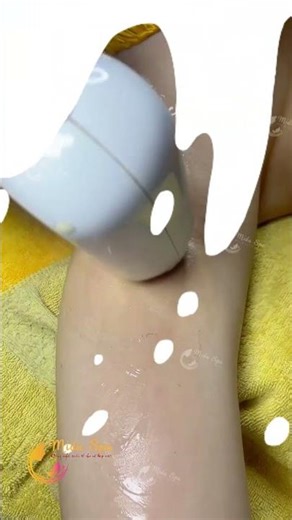 Midu Spa Cam Kết Triệt Lông Nách Không Đau – Bảo Hành Trọn Đời