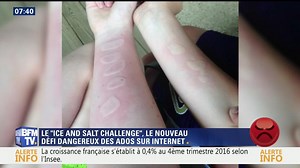"Ice and salt challenge", le nouveau défi dangereux des ados sur internet - 31/01