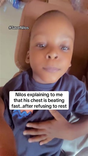 Understanding Open Heart Surgery Insights