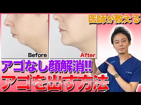 医師が教える！アゴを出す方法