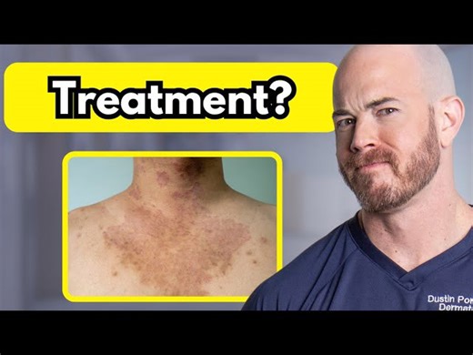 Summer Rash Explained: What You Need to Know About Tinea Versicolor