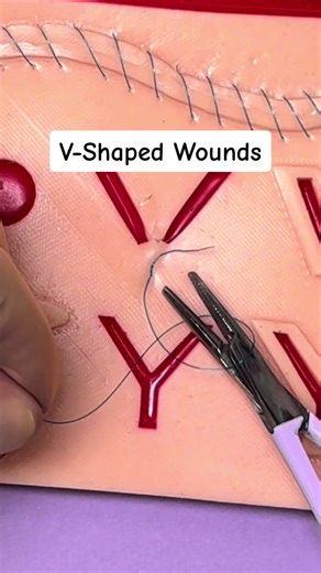 V-Shaped Wounds 😷 #vetstudent #medicalstudent #clinicalskills #suturepad #sutureing