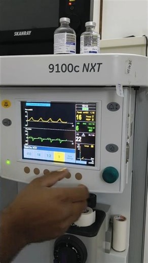 Understanding of PEEP #anesthesia #shorts #informativevideos #viral