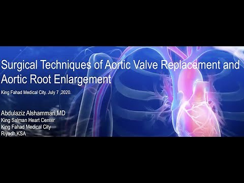 Surgical Techniques of Aortic Valve Replacement and Aortic Root Enlargement