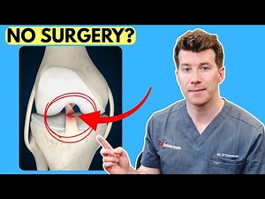 Recovering From an ACL Tear Without Surgery (Doctor Explains)