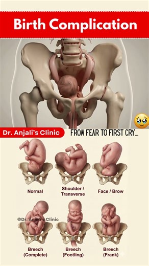 They prepared for complications… but got a miracle