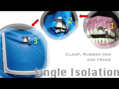 Different Rubber Dam Isolation Techniques, Episode 1 by Dr. Ida Viloria, DMD, Phd