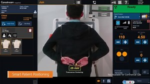Carestream ImageView Software powered by Eclipse is the engine behind our innovative imaging software platforms. It uses AI technology and proprietary algorithms to significantly increase the value of the entire imaging chain, from capture to diagnosis. Take a closer look at our new workflow efficiency features using the DRX-Compass X-ray System. To learn more about the DRX-Compass, visit here: https://www.carestream.com/en/us/medical/dr-systems/x-ray-rooms/drx-compass | Carestream | Facebook