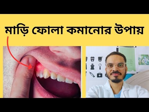 মাড়ি ফুলে গেলে করণীয় | Gum Swelling Treatment in Bangla | Dental Care Tips