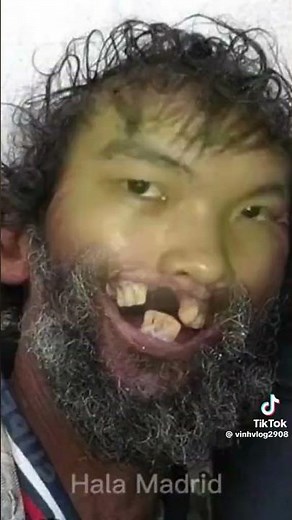 thử thách cấm cười cấp độ vô hạn#Shorts