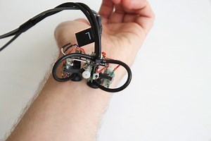 MIT’s Skinbot is a wearable robot that’s designed to scamper all over your body