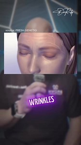 5.4K views · 42 reactions |  Botox vs. Filler — What’s the...