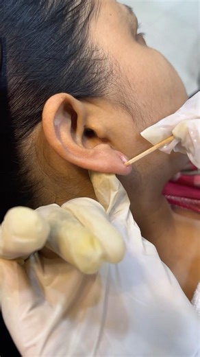 Ear hole💯 //how to close it // |Prachi Makeover| #ear hole #earings #bighole #shorts #viralshorts