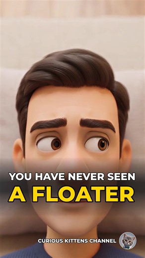 What happens when you see floaters in your eyes #shorts