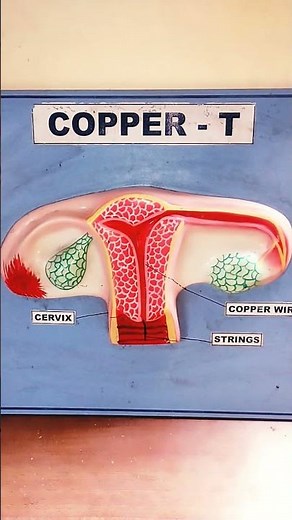 cooper -T|reproductive system|female reproductive system|vegina #viral #biology #reproductivesystem