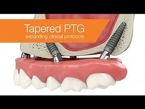 Tapered PTG dental implants: Expanding clinical protocols