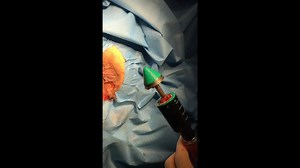 Hémorroïdes - Longo