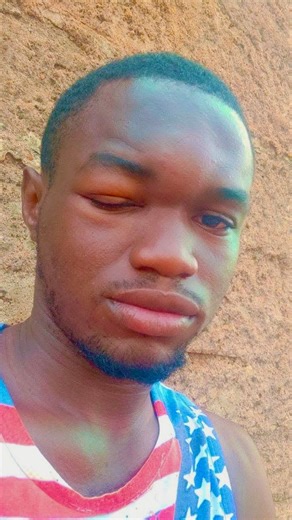 📢 FORMATION COMPLÈTE EN APICULTURE – OUAGADOUGOU 2026 🐝🍯 Tu veux te lancer dans l’apiculture ou améliorer ta production de miel ? Ne rate pas cette formation pratique et professionnelle 💪 📅 Du 27 au 29 mars 2026 📍 Ouagadougou ✅ Formation pour débutants et praticiens ✅ Théorie pratique ✅ Suivi après formation ✅ Attestation ✅ Stage possible 💰 Prix : 👉 Avec kit : 92 000 F 👉 Sans kit : 25 000 F 📞 Infos & Inscriptions : 226 74 12 44 48 / 62 48 48 78 🚀 Investis dans ton avenir dès maintenan