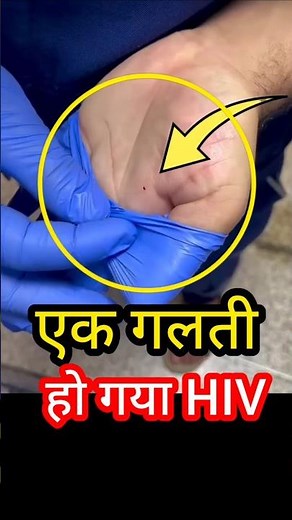 HIV