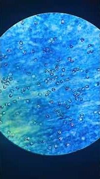Tinción de Kinyoun cryptosporidium parvum #microscope #medstudent #biologia al microscopio ￼