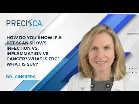 How do you know if a PET scan shows infection vs. inflammation vs. cancer? What is FDG? What is SUV?