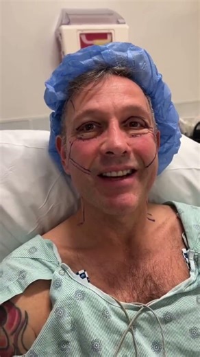 Joseph Two Months Post Op. Reveal | Dr. Ramtin Kassir | New York City #shorts