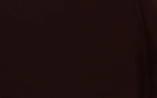 New and Improved Metacarpus Encabulator!