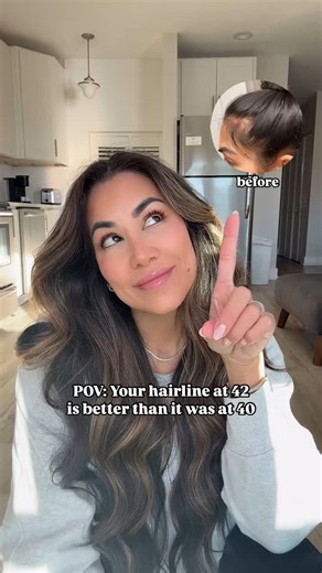 Jen Ronzitti | Hair Growth & Hair Transformation Specialist on Instagram: "✨Not only is my hairline full, I was able to add double the density & thickness everywhere! • 👉🏻What you did in your 20s and 30s for skin care won’t work the same as when you’re 40…same thing goes for your scalp & hair! • A telltale sign your scalp is aging is thinning hairline, excessive hair fall, super oily or super dry roots, itchy scalp… • Your scalp is an extension of your face. Did you know it ages faster than ot