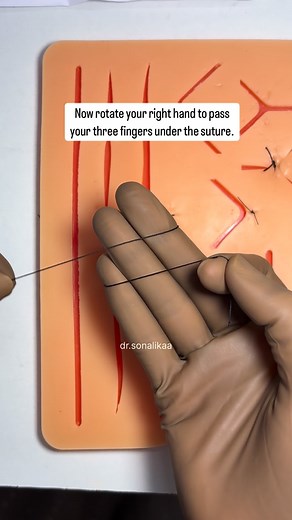 Dr. Sonalika Gupta | 🩺 Ever wondered how surgeons tie knots with one hand? Here’s the trick to master the underhand throw step-by-step — smooth, controlled,... | Instagram