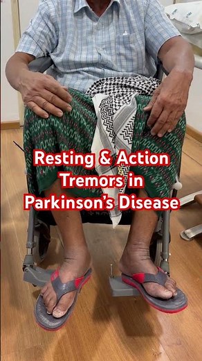 Resting and action tremors in a person with Parkinson’s disease of 10 years duration