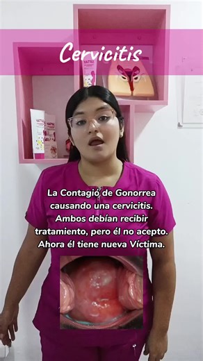 La cervicitis es una inflamación del cuello uterino, el cual suele ser ocasionado por Gonorrea o Clamidia. Los síntomas son: *Dolor en la intimidad *Sangrado después de intimidad *Flujo color amarillo. Tienes dudas? 📱:956381045 #fyp #foryou #parati #viral #cervicitis #gonorrea #clamidia #its #ets #obstetra_itala #obstetra_agapito #obstetra #villamariadeltriunfo #consultorio