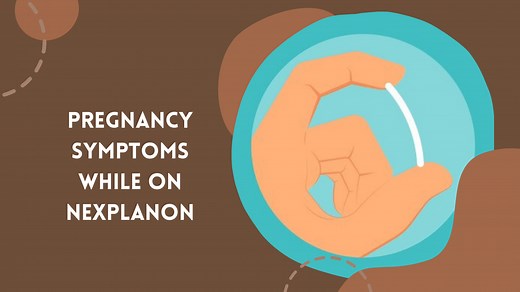 Pregnancy Symptoms While On Nexplanon: Your All-In-One-Guide!