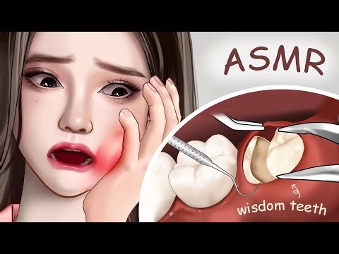 ASMR Remove Wisdom Teeth | Deep Cleaning Treatment